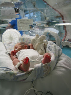 HELLP syndrome story